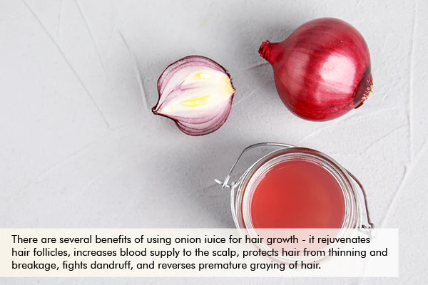 Benefits of shop onion juice