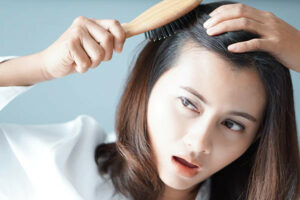 hormonal imbalance and hair loss