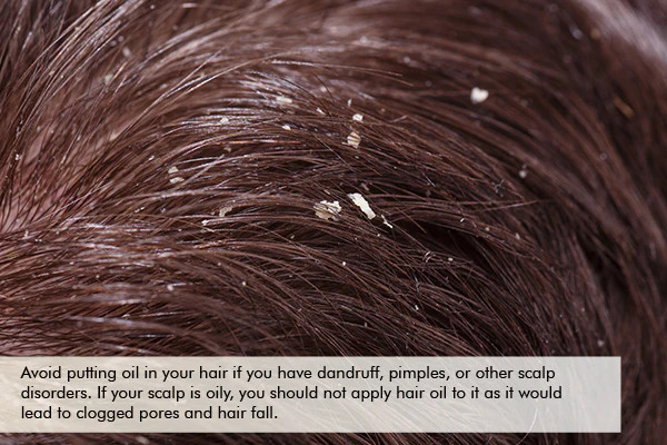 avoid oiling your hair if you suffer from dandruff or scalp disorders