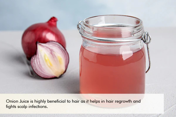 Benefits of Using Aloe Vera & Onion Juice for Hair Growth