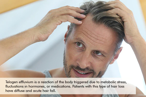 hair loss due to telogen effluvium