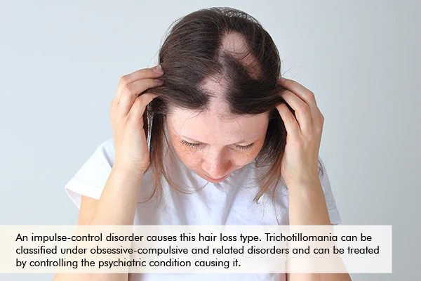 hair loss due to trichotillomania