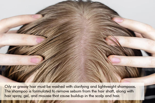 Oily scalp deals hair loss