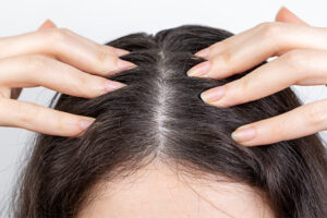 how to get rid of dried blood crusts on he scalp