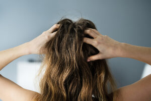 ways to remove scalp buildup naturally