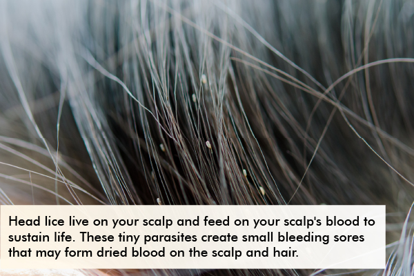 reasons responsible for appearance of dried blood on your scalp
