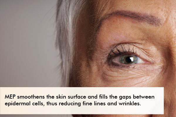 MEP smoothens the skin surface and reduces wrinkles and fine lines